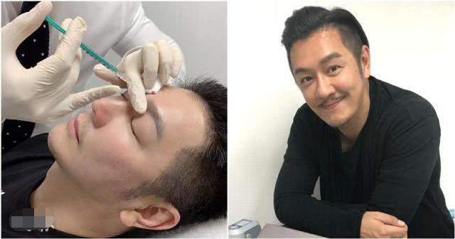 刘恺威整容后遗症_娱乐圈没整过容的明星_华晨宇整容